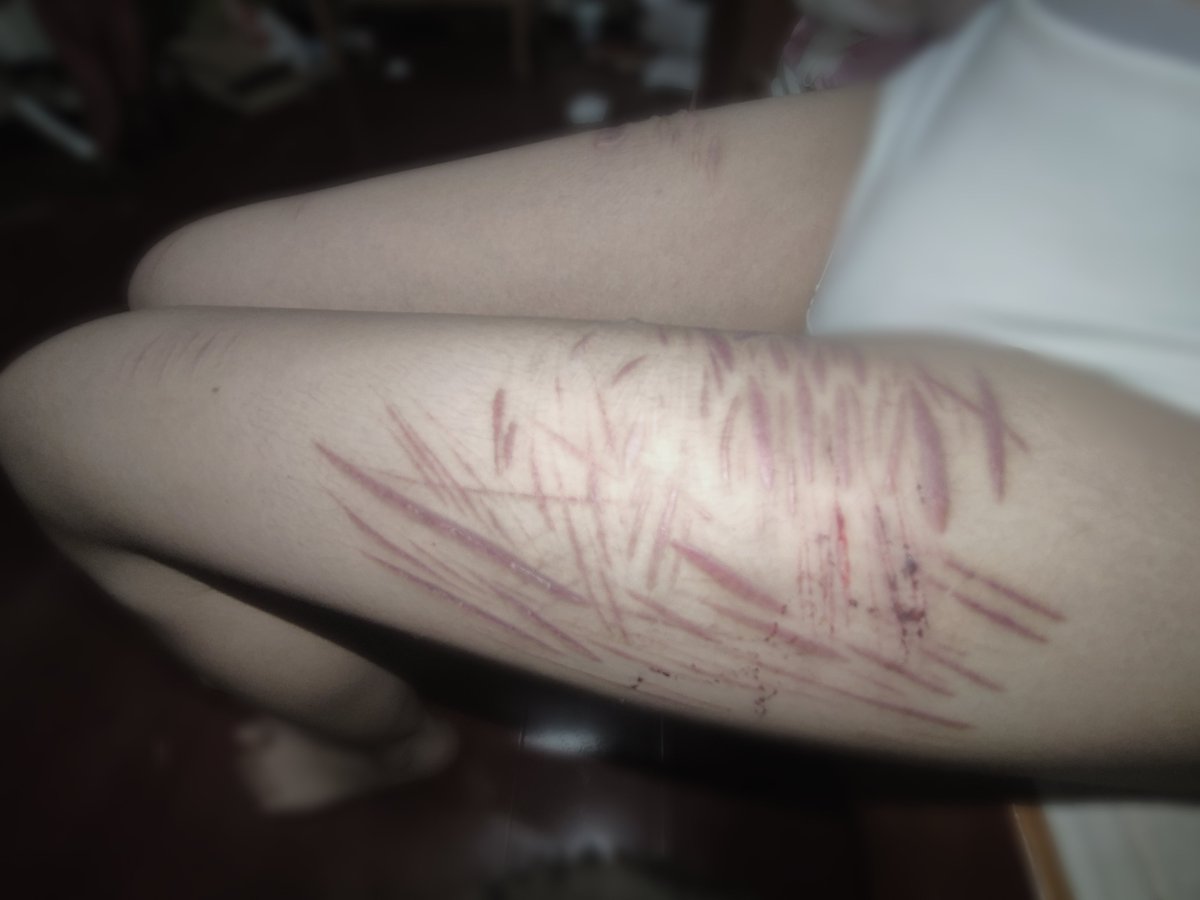 haomali0p's tweet photo. ALL FAKE
#slittwt #shedtwt #988twt #自残 #自傷行為 https://t.co/jtN1jfEfw9