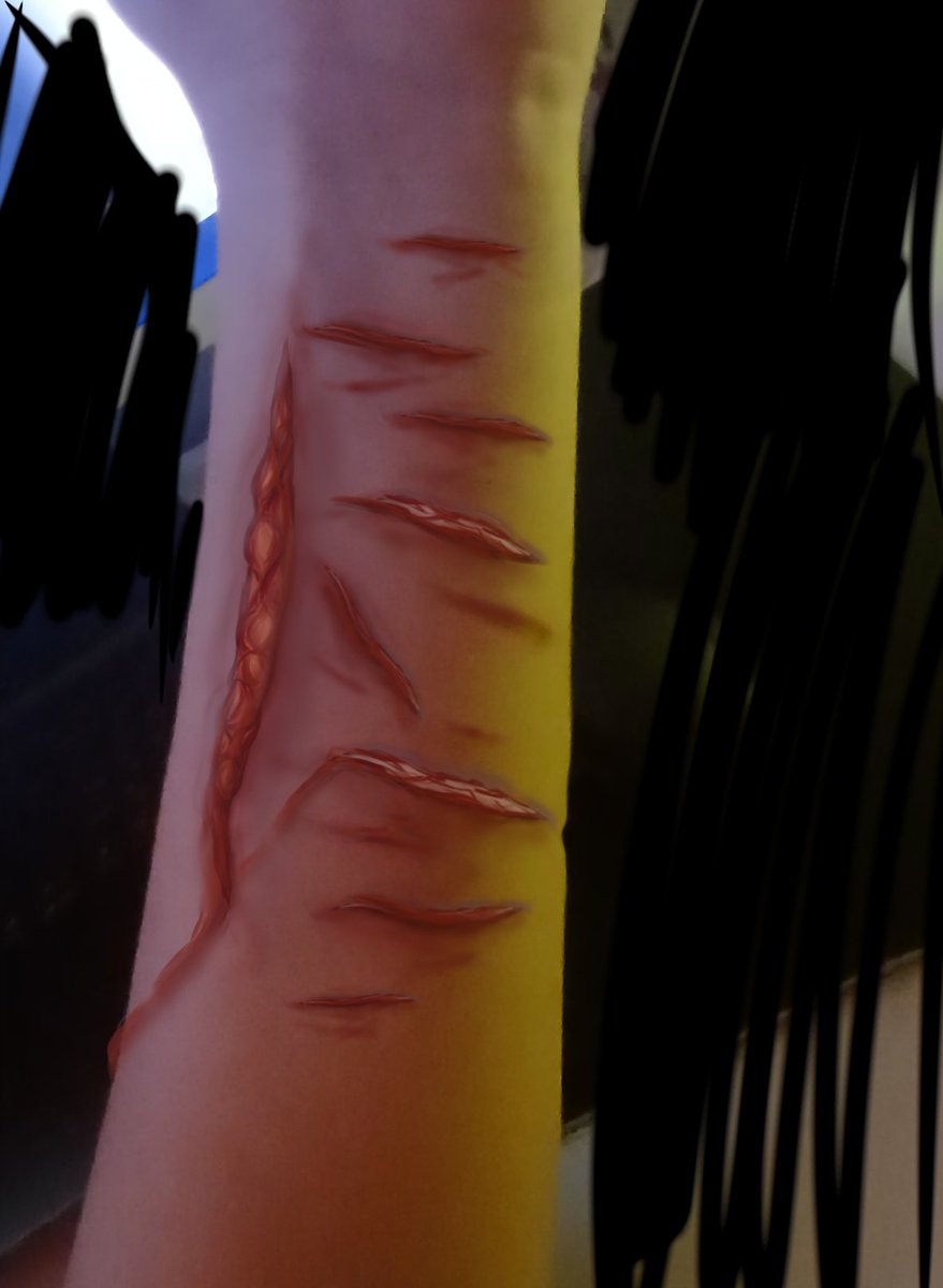 idkywop's tweet photo. Sfx fake!!

Its actually fake since u can't cut i drew it on ibis all fake
#shtwt #makeupsfx https://t.co/Dsvc7xpS28