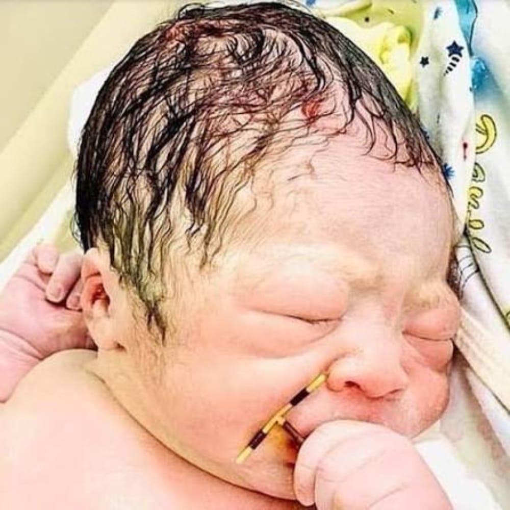 EnsedeCiencia's tweet photo. 👶🇧🇷 Matheus Gabriel nació sano en Brasil pese a que su madre quedó embarazada mientras utilizaba un DIU de cobre. Los médicos decidieron no retirarlo por los riesgos. Tras el parto, la obstetra colocó el dispositivo en la mano del bebé y la imagen se volvió viral. https://t.co/Rk9DOffhNt