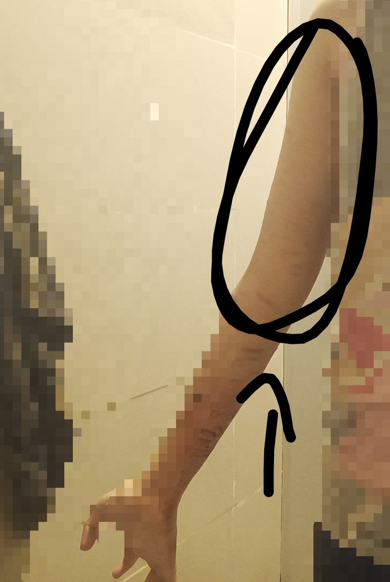 magpiehater's tweet photo. please tell me faster ways to lose fat on your arms im so ugly im so fat can I just suck the fat off https://t.co/KHLCy0tIBU