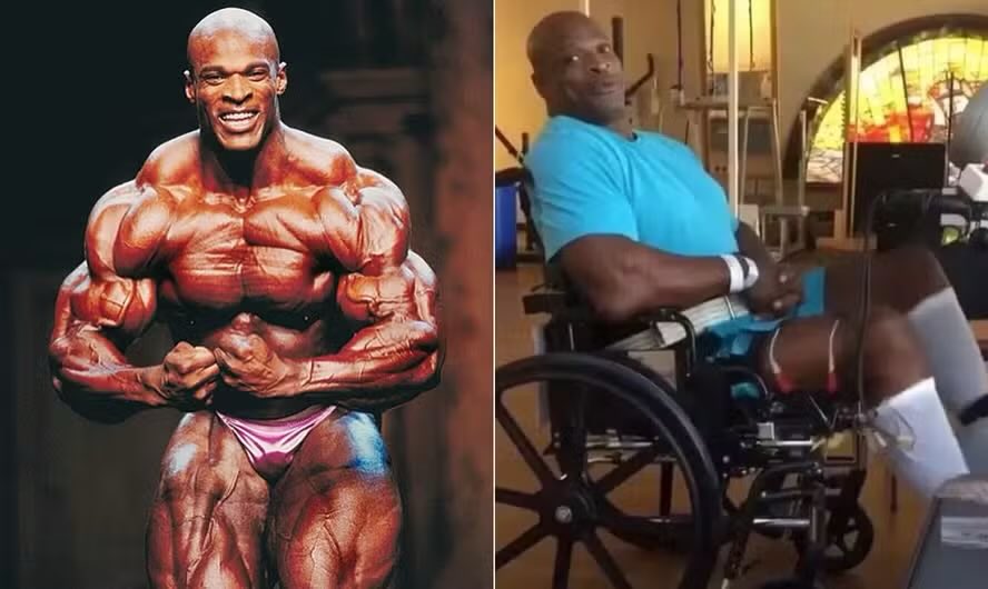 RooFrann's tweet photo. Sabe o que esses dois físicos podem ter em comum?

Sarcopenia

A quantidade de massa muscular ≠ força ≠ qualidade muscular ≠ performance

Considerada uma insuficiência muscular, na qual a baixa força muscular é o determinante principal, ultrapassando a baixa massa muscular https://t.co/1MivXfDYq1