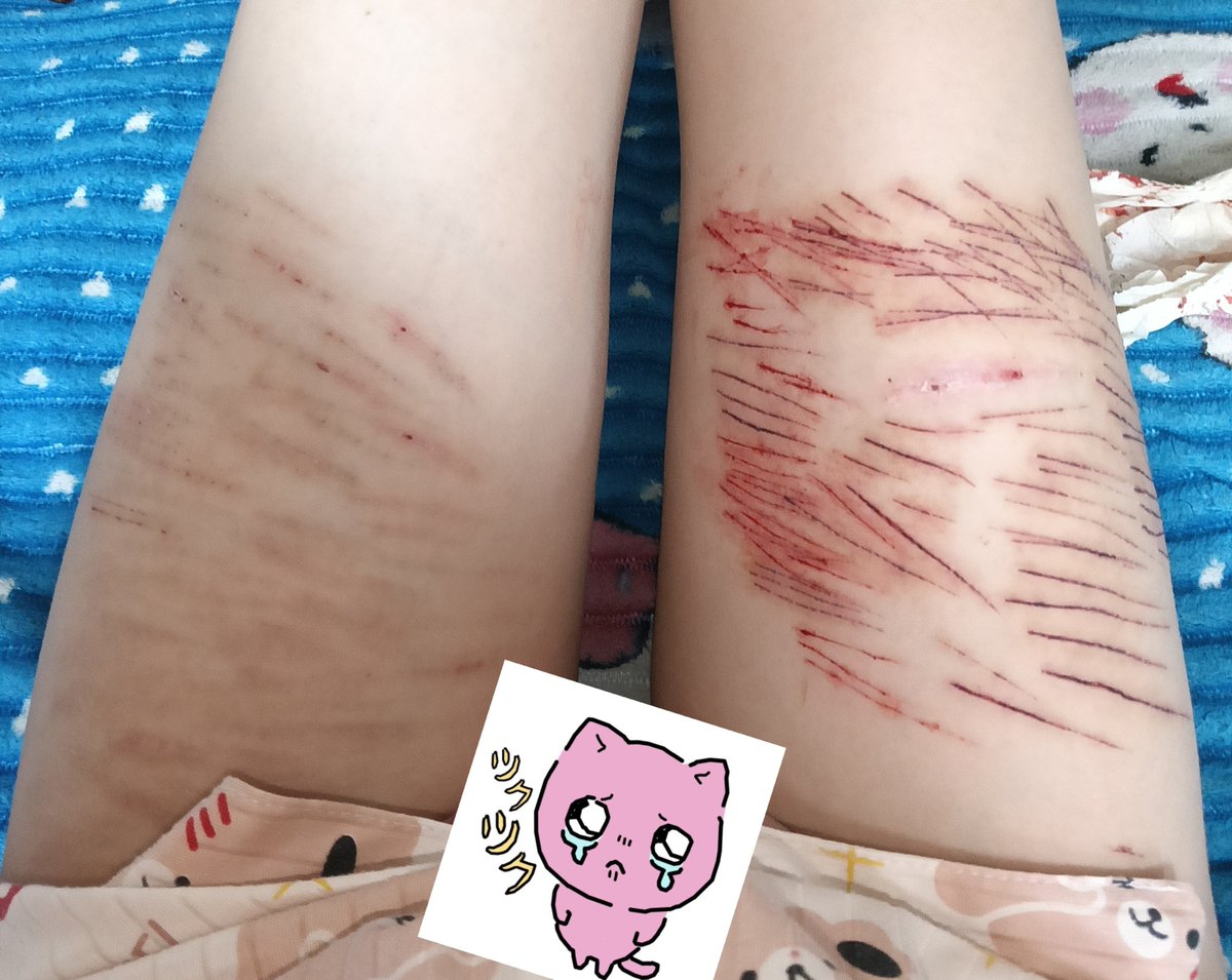 expiredangelxx's tweet photo. SFX Halloween makeup test 🩷🩷 https://t.co/1HsSuZrSmI