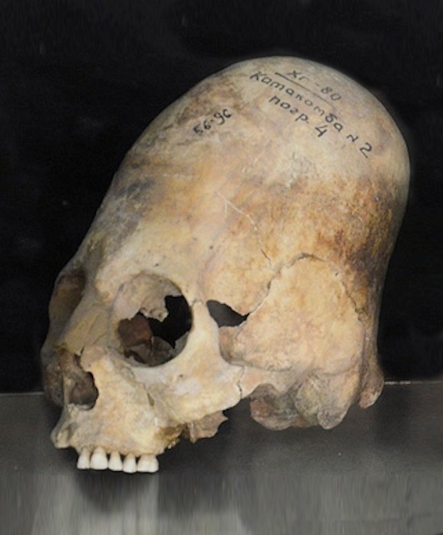 feathergoldmari's tweet photo. I think slavs just practice mandatory cranial deformation when they are born that's the only possible explanation for why they're all like that https://t.co/fhUDphK8CN