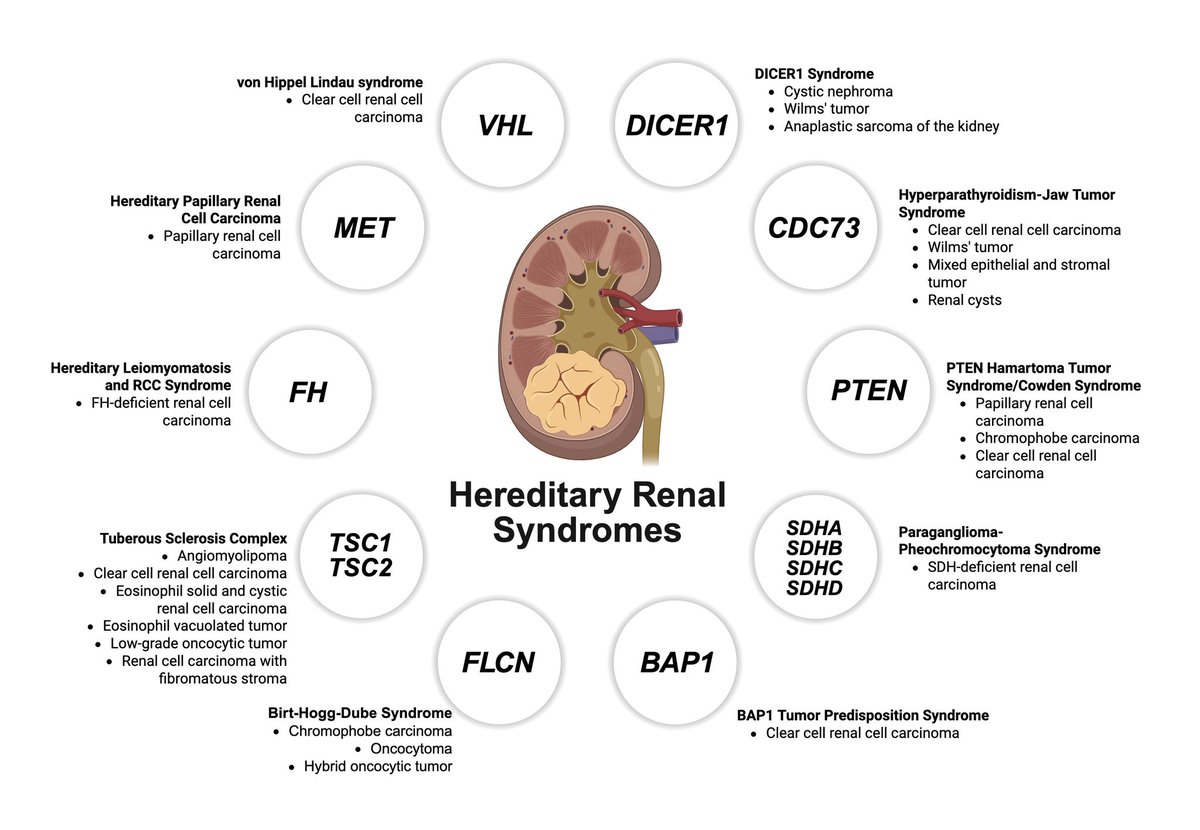 LiangChengMD's tweet photo. I am delighted to share our recent article published in European Urology (Journal Impact Factor: 29) @EUplatinum - “Hereditary Renal Cancer Syndromes: Redefining Clinical Management in the Era of Precision Medicine” (PMID: 42580957), written by Dr. Fanni Santa, @FV_Santa an arising star in our field. 

Hereditary renal cancers account for an estimated 3–5% of renal cell carcinomas, yet many affected patients remain unrecognized and never undergo germline testing. Our article highlights the growing importance of identifying hereditary disease and emphasizes that surveillance and treatment should increasingly be guided by tumor biology, molecular classification, and genetic testing.

The therapeutic landscape is rapidly evolving. HIF-2α inhibition has established proof of principle for genotype-directed therapy in VHL-associated RCC, while emerging strategies include next-generation HIF inhibition, immunotherapy-based combinations, metabolism-directed therapies for FH- and SDH-deficient RCC, and biomarker-driven approaches to improve risk stratification and treatment selection. 

Important challenges remain: refining risk-adapted surveillance, optimizing intervention thresholds, developing syndrome-specific systemic therapies, and generating stronger prospective evidence. International registries integrating genotype, tumor growth, treatment history, renal function, and cancer-specific outcomes will be essential for moving the field toward more precise and dynamic management. 
The future of hereditary kidney cancer care lies in integrating pathology, germline genetics, surveillance, surgery, and pathway-directed systemic therapy to deliver truly individualized precision medicine.

Article is available for free download: https://t.co/lWvVZkYrir