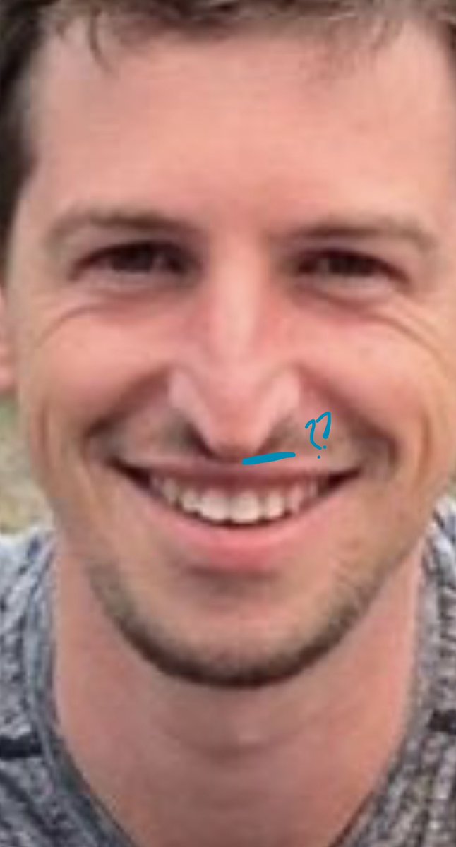 sofresh_sobleam's tweet photo. Been following the jews and their bullshit for quite sometime… so it’s not often that I hear anything new about them…. 

A little while ago, a friend of mine said… well.. it’s not necessary the SIZE of their nose… but it’s that lack of gap between their upper lip and their nose. 

Now I can’t unsee it. Seems there’s a specific jewish phenotype that has this trait and it’s absolutely disgusting, I hate it. Now I’m gonna share it with you …  

Aiden Ross for example.. his nose isn’t that big but look at it, almost touching his mouth 😭