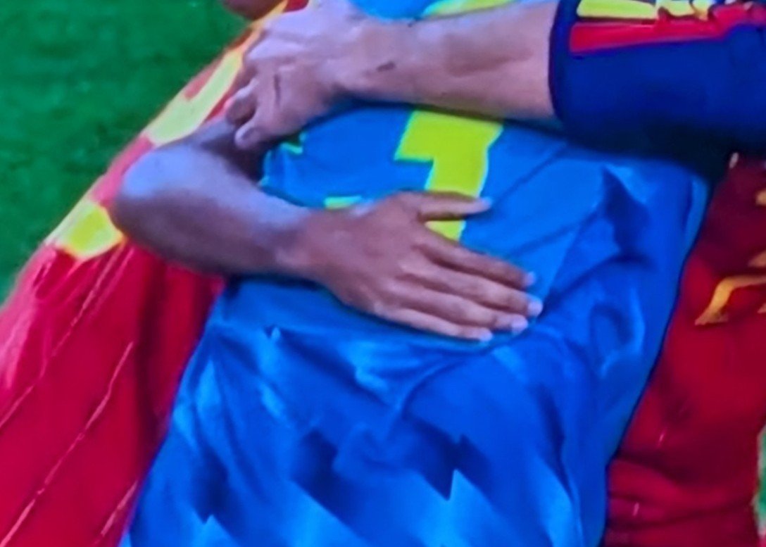 JokerLaporta's tweet photo. Vaya... Lamine Yamal con España no lleva vendaje aparatoso ni 2 dedos juntos vendados porque se arriesga a una inhabilitación de UEFA.

Luego llega a Barcelona y parece una momia como Raphinha. 

D O P A J E 🧪🧫⚗️🌡️💉💊🩹 https://t.co/4am4piu0gI