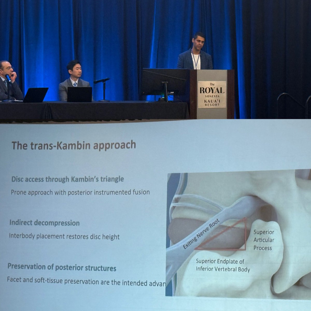 jerjohnson's tweet photo. Dr. Prado presents single surgeon series of KLIF approach for spinal fusion #WestNsurg2026 #spine #neurosurgery https://t.co/ydKqsQ6p9h