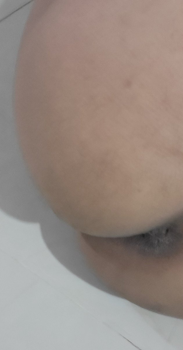 alfjsjhjsj's tweet photo. من الخاص👇 
سالب من المكلا 29 سنه ممحون 
يريد موجب بس يكون نضيف من المكلا 
الذي بالمكلا يجي خاص يكون جاد 🔥 https://t.co/etb6nM7wIX