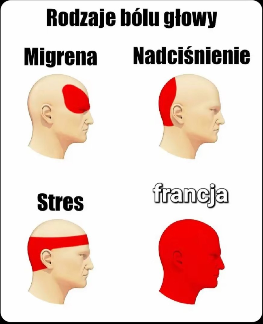 michalina188481's tweet photo. #gangłysego https://t.co/C2KdkJPlcF