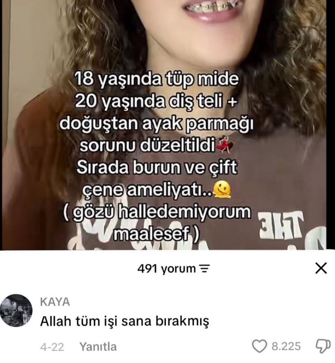 firattavcciii's tweet photo. Gecenin gidişat https://t.co/qHGQgcHVje
