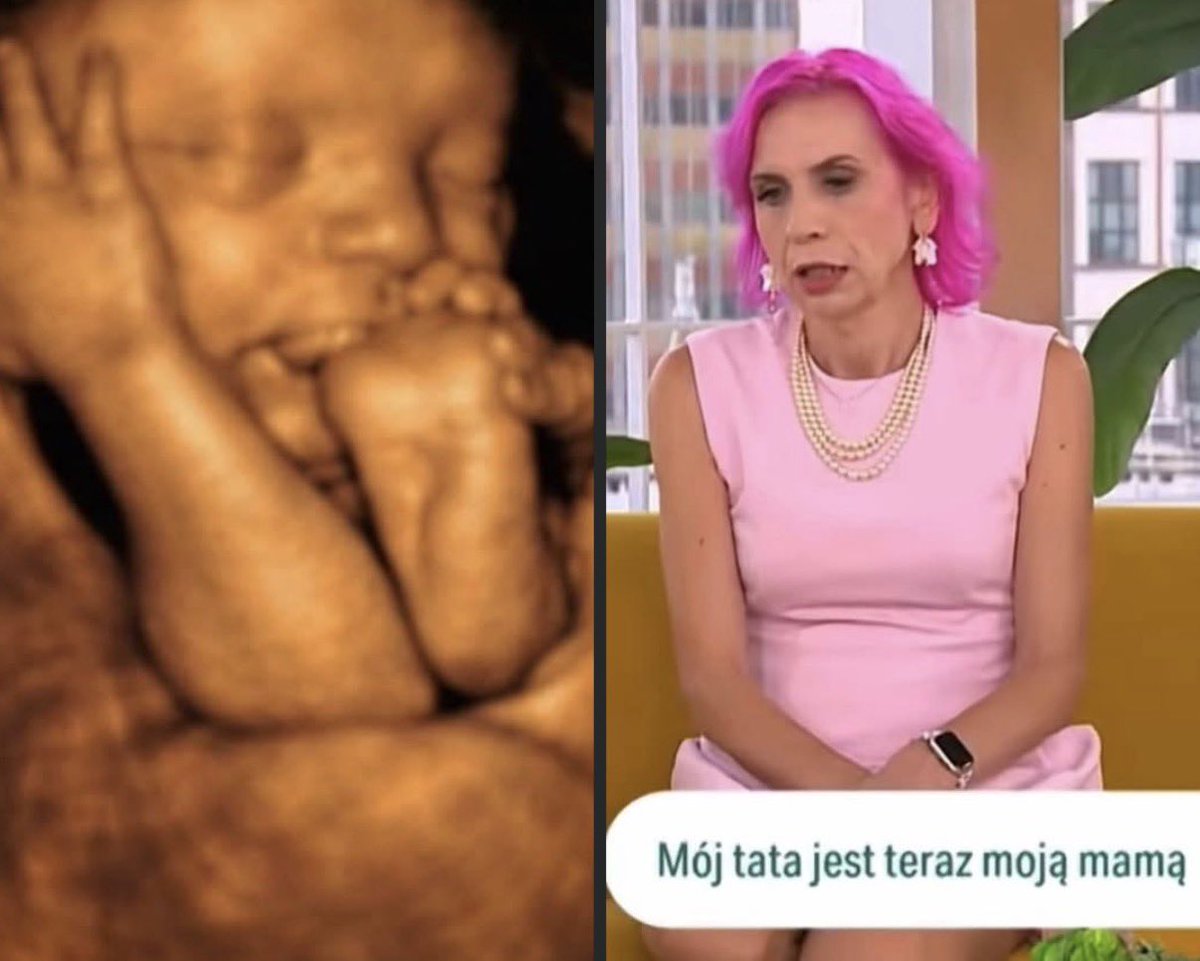 piotr_bartosz's tweet photo. Jak potężna musiała być propaganda, aby przekonać cześć społeczeństwa, że ten po lewej „nie jest człowiekiem”, a ten po prawej „jest kobietą”. https://t.co/QQTtEZkM8v