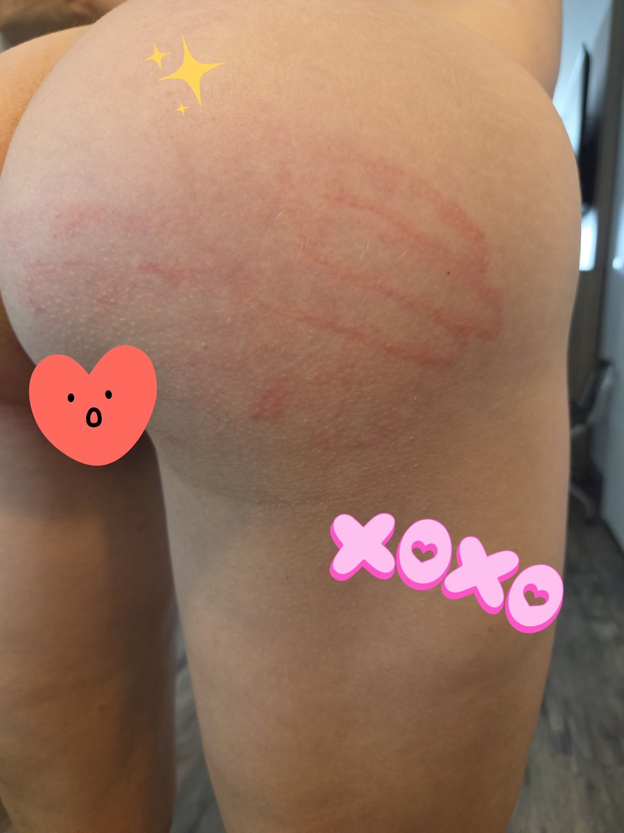 balletnocturne's tweet photo. I do love a good spanking! Look at that handprint @JayMoorcock https://t.co/buv7DPMp8l