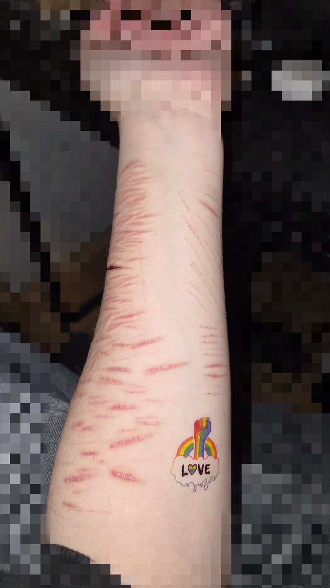 knoxforever15's tweet photo. do we like my fake Tattoo? and my sfx make-up aswell?
#slitwt #shredtwt #scartwt https://t.co/qWLpD14kOx