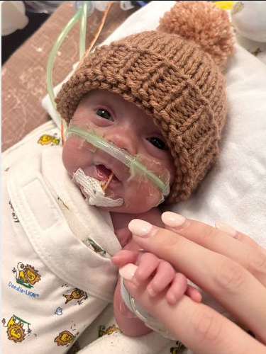 iarsuaga's tweet photo. Aquí hay un bebé nacido a las 25 semanas. No es un cúmulo de células. No es un parásito. No es una cosa. Es un bebé. Un ser humano. Que no debería ser abortado. https://t.co/p1sV0MnJH0