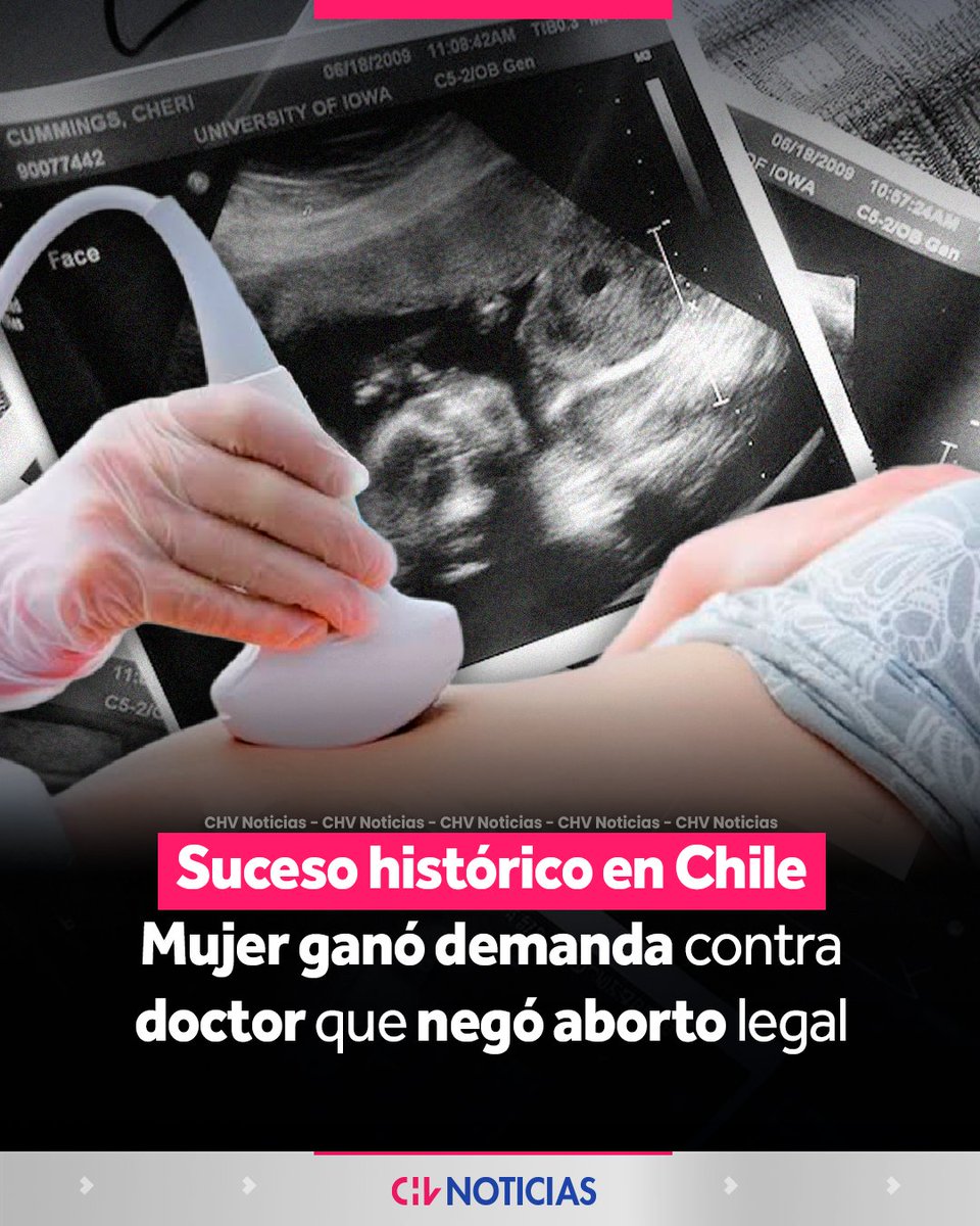 chvnoticias's tweet photo. POR PRIMERA VEZ EN CHILE 

⚖️ La justicia falló a favor de una mujer que demandó a un médico por impedirle acceder a un aborto legal bajo la causal de inviabilidad fetal.

🫄El caso se remonta a 2018, cuando Catalina Pizarro tenía 12 semanas de gestación y acudió a la Clínica Tabancura tras detectarse complicaciones en el embarazo. Según los antecedentes del caso, el médico Eduardo Carstens le negó la interrupción del embarazo.

🪙El tribunal determinó que existió una “obstrucción ilegal” del procedimiento y que se entregó información errónea a la paciente. Por ello, ordenó al médico pagar una indemnización de $100.275.000.

#CHVNoticias #CHVNacional