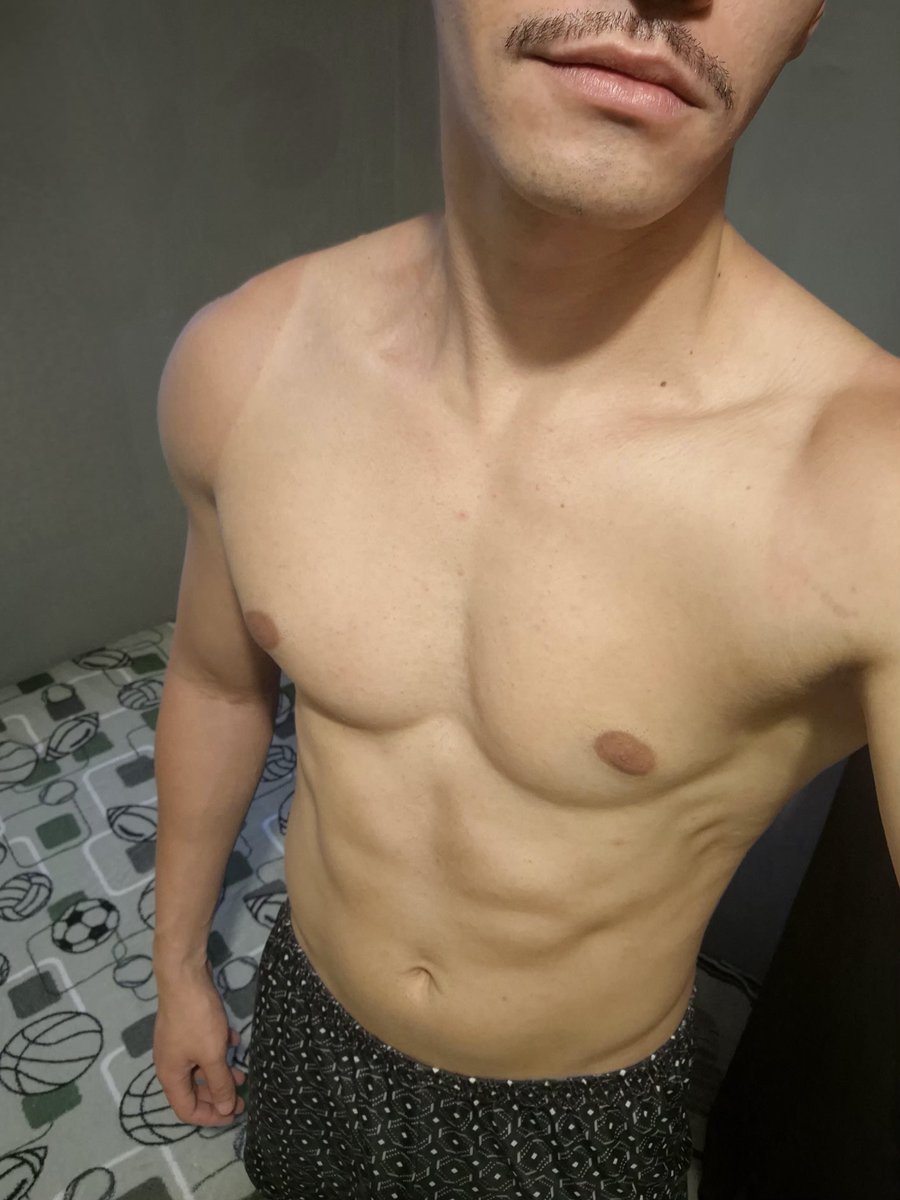 Aquademus's tweet photo. Levemente queimado... acho que tomei Sol demais hoje 🔥🔥 https://t.co/nzwSVfjRx8