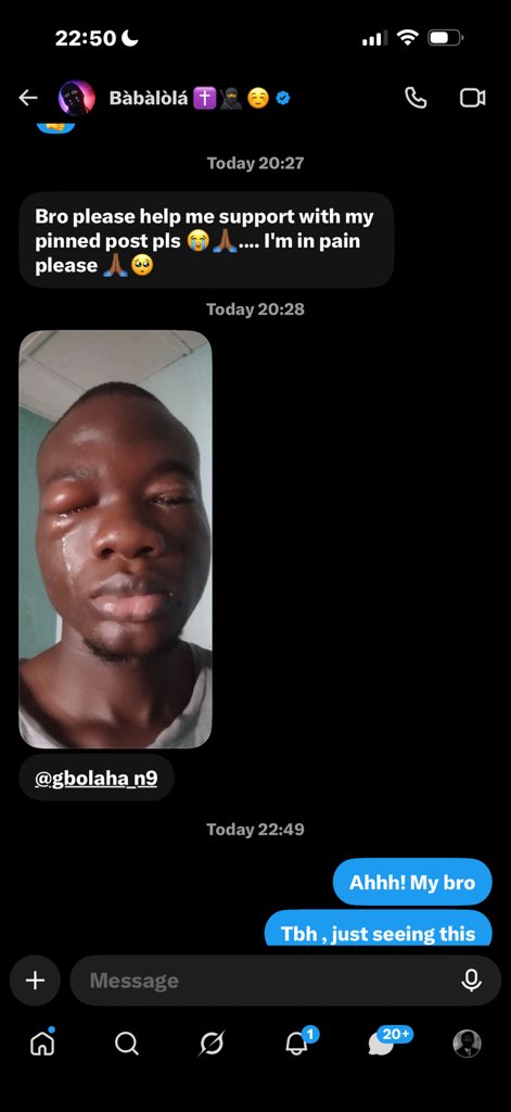 gbolaha_n9's tweet photo. Please, if you’re seeing this, kindly help me reshare so he can reach as many people as possible and get the support he needs. He’s currently in pain. 🙏 https://t.co/BM6SrnpQUD