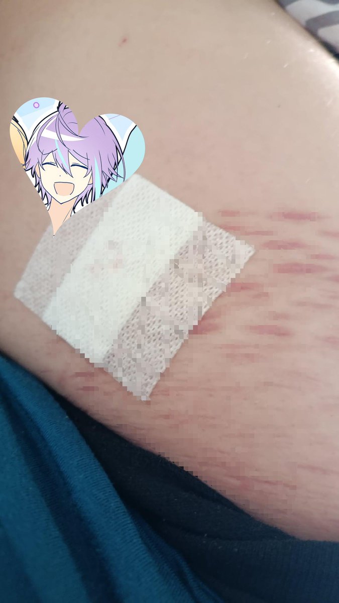 lotus__143's tweet photo. Cuts from 2 days ago also sorry for the bad quality.

#SFX MAKEUP, EDITED, PRACTICING FOR HALLOWEEN, MADE WITH AI https://t.co/XpJg2WqdCb
