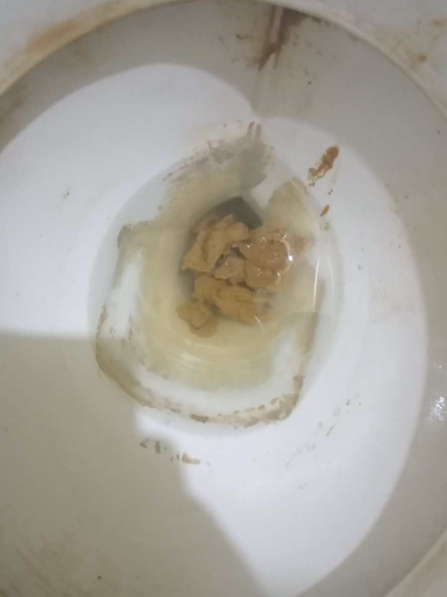 taya99548's tweet photo. #poop #urgent https://t.co/i5fMJ830y8