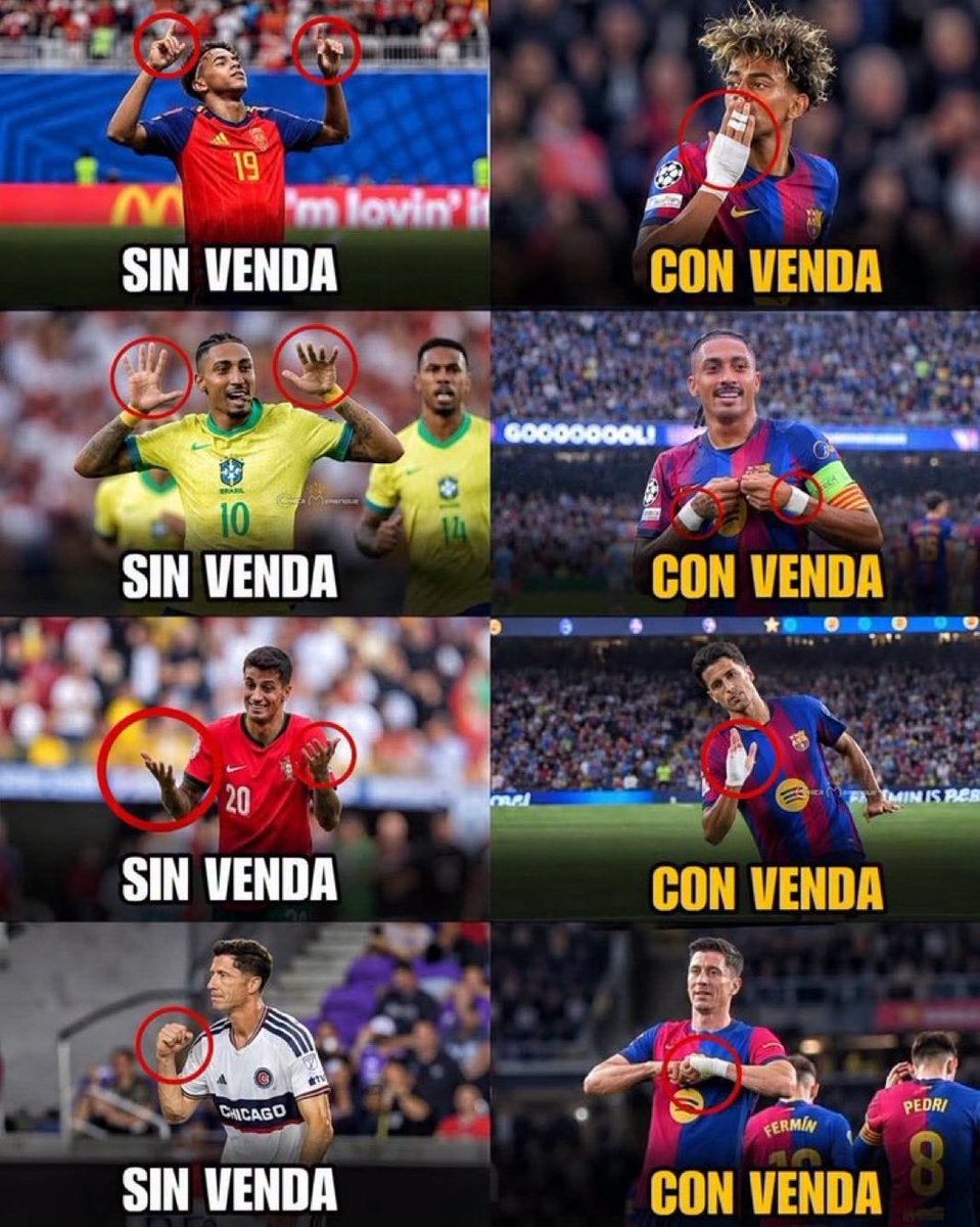 AdriRM33's tweet photo. "Las vendas mágicas." https://t.co/vHc7W4KipQ