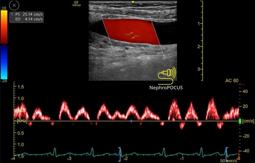 NephroP's tweet photo. Easy quiz today!
Artery or vein? (neck)
#POCUS #FOAMed #Nephpearls https://t.co/ADM7pU1NQl