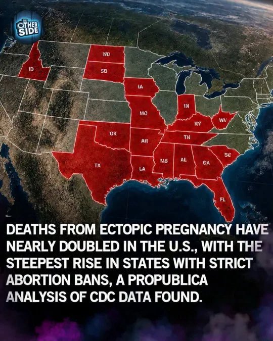 colonelhogans's tweet photo. America is no longer safe for women’s healthcare. 

With the increase in RW Christian nationalism and their desperation to control women’s minds and bodies, deaths from ectopic pregnancies has doubled. 

Women in many American states have lost all control over their health choices due to abortion bans from RW religious zealot governments. 

One Nation has guaranteed a nation wide abortion ban. 

Don’t allow them to control Australian women’s health choices.