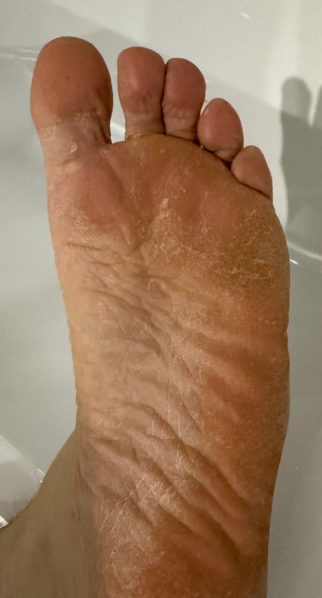 Real_NoFilter's tweet photo. Woke up like this…. Rough, hard and a bit smelly! https://t.co/tQAMU1xh9x
