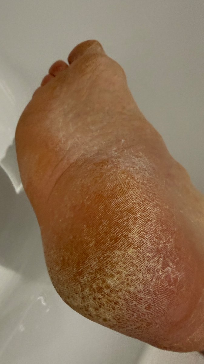 Real_NoFilter's tweet photo. Woke up like this…. Rough, hard and a bit smelly! https://t.co/tQAMU1xh9x