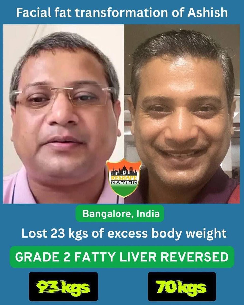 HaydeeMizej9e4's tweet photo. Lost 23 kg! From 93 kg to 70 kg—a life-changing transformation. A healthier body, sharper appearance, and newfound confidence. Proof that consistency can lead to incredible results. https://t.co/ByqFggIyjI