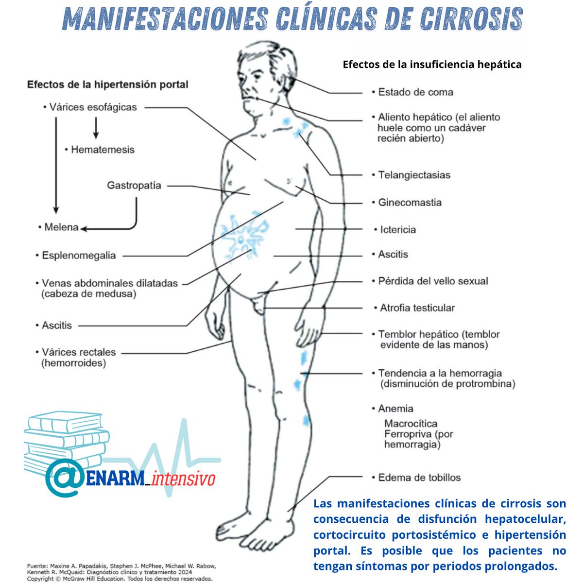 ENARM_intensivo's tweet photo. 📌MANIFESTACIONES CLÍNICAS DE CIRROSIS

#ENARM_INTENSIVO #ESTUDIA_MEDICINA https://t.co/OJXsoklPaE