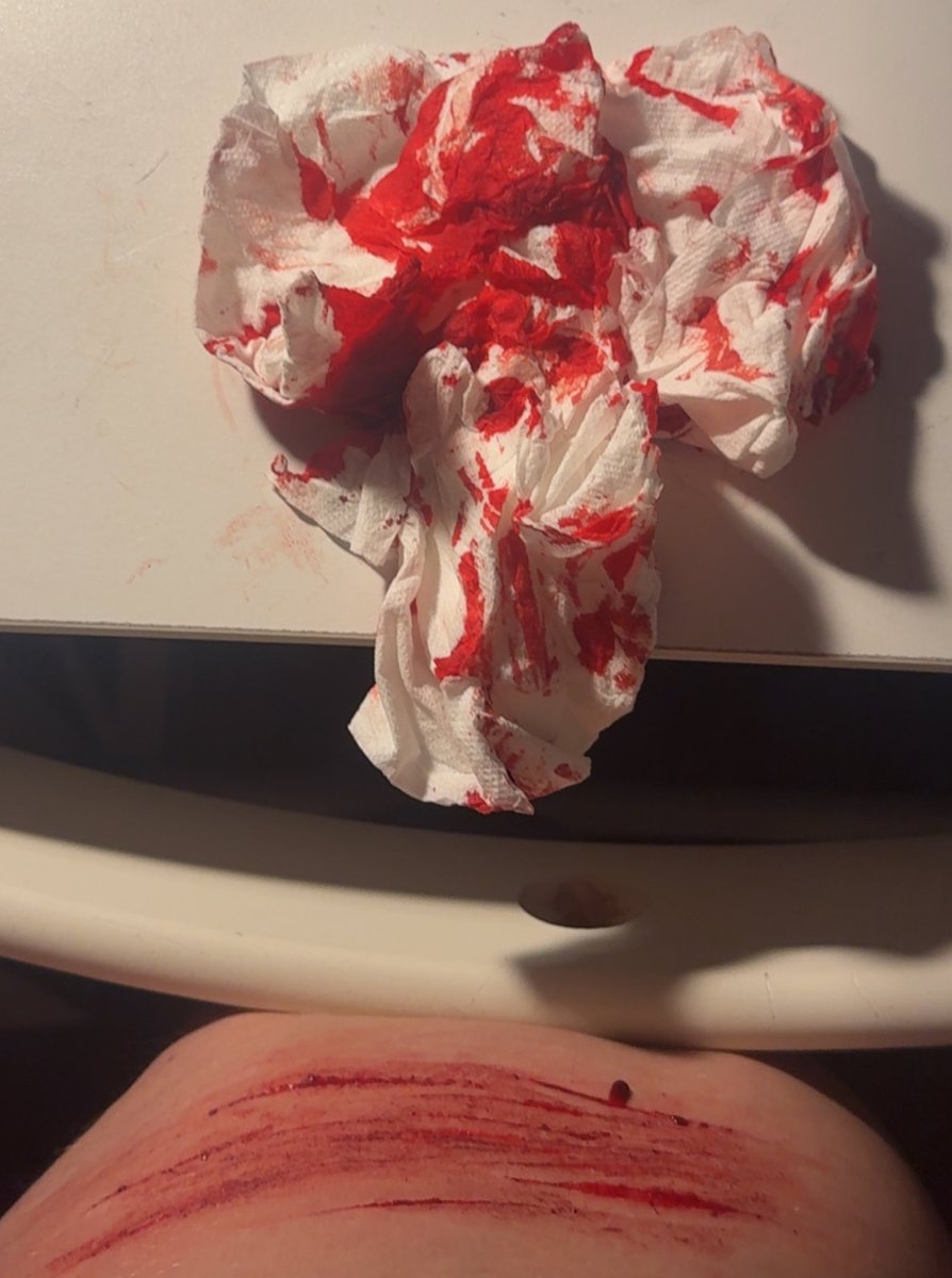 rattlecakes_'s tweet photo. SFX MAKEUP !!
- 
-
-
ouchietwt shtwt beanstwt styrotwt
-
Its fine its fine its fine its fine https://t.co/K77pxYLLj9