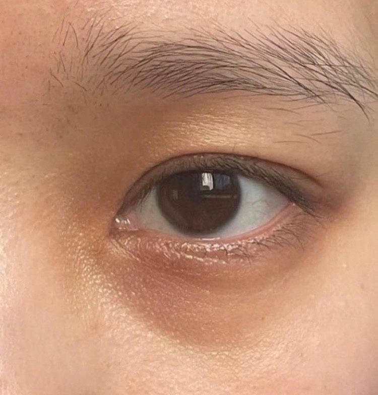 skin_gw's tweet photo. こういう、『目元のクマひどくて寝不足風女子』ｺﾚ使ってみ、クマ飛ぶぞ？ https://t.co/fQUCYdpKpY