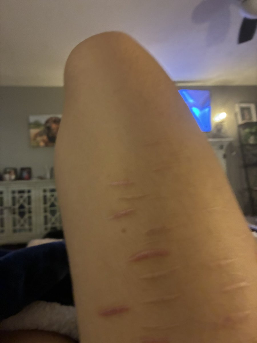 cutting4_1stime's tweet photo. I hate my thighs they look like a chicken tender bro☹️☹️☹️ https://t.co/2gdv2EpPdz