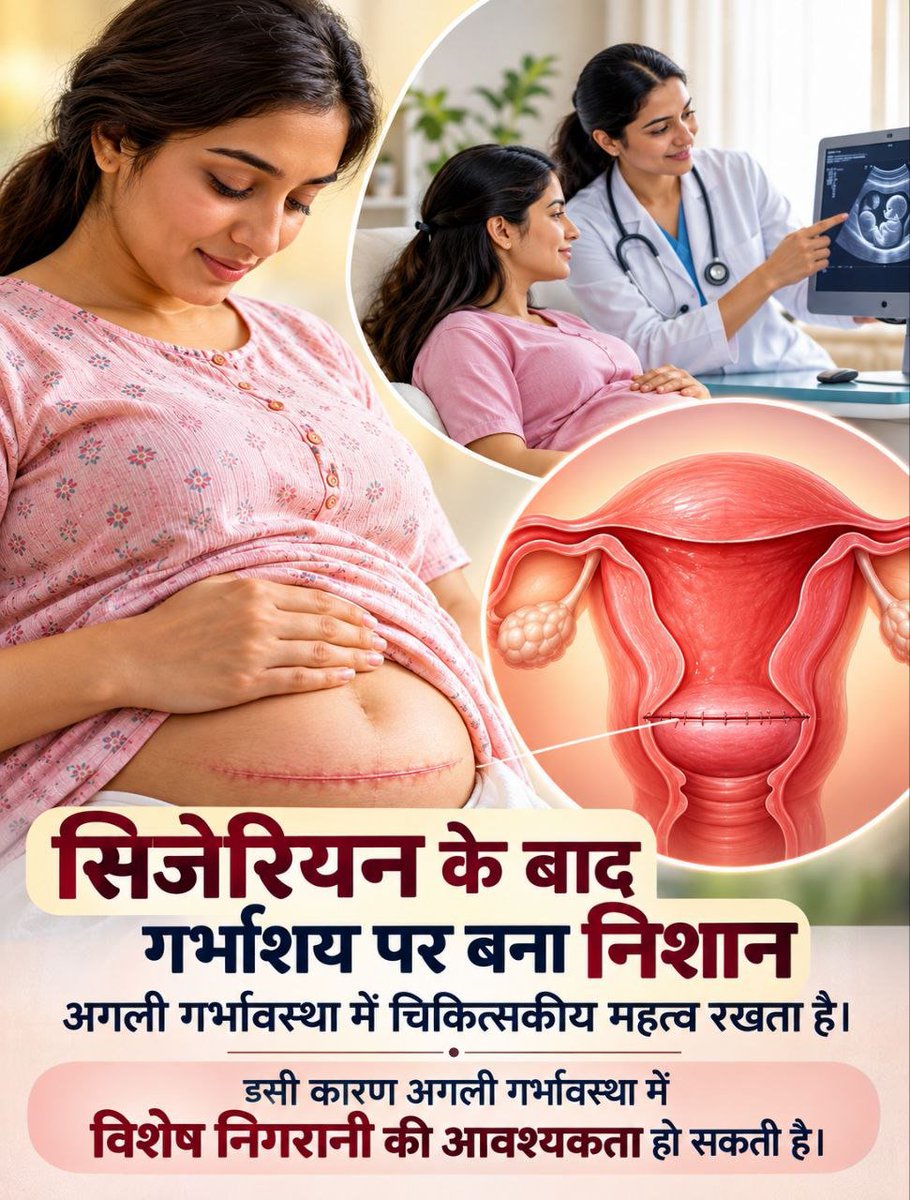 Harshitparx6n's tweet photo. C-section कई परिस्थितियों में माँ और शिशु के लिए जीवनरक्षक हो सकता है, इसलिए निर्णय चिकित्सा-स्थिति के आधार पर होना चाहिए। #SuprasavAbhiyan के माध्यम से Pregnancy Awareness बढ़ाएँ। Sant Shri Asharamji Bapu की प्रेरणा से सही जानकारी जन-जन तक पहुँचाएँ। https://t.co/EgAbhhaLCj