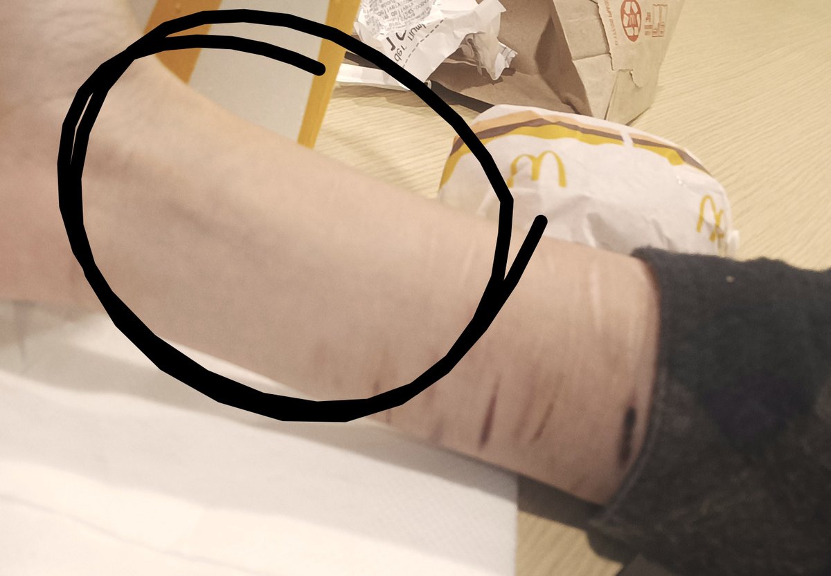 magpiehater's tweet photo. I avoid this spot on my other arm idk why I only do shallow cuts there and it heals pretty fast https://t.co/P5ykVLblS1