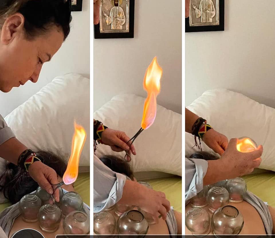 JuliWierzbdqdf's tweet photo. Cupping therapy https://t.co/9JBJ8v07Ph