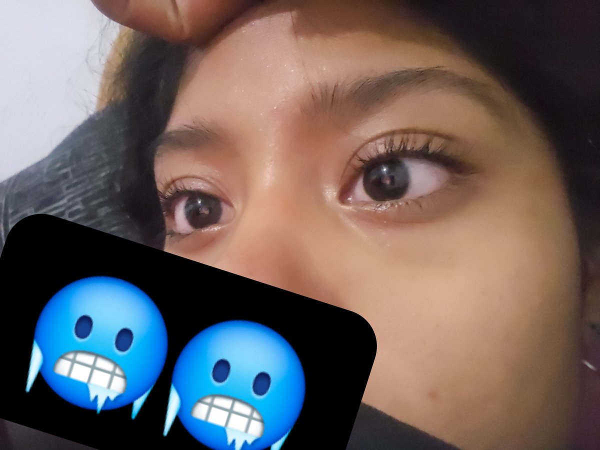 mugrosa095's tweet photo. Los ojos todos cristalinos💔
#drugtwt https://t.co/70CbSNQyrC