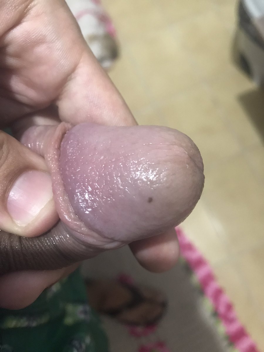 CasaDaMandinga's tweet photo. @VictoriaX1999 Mole mesmo não tinha uma foto que essa mancha aparece
Já vou aproveitar que eu levantei e vou comer https://t.co/xO7yVmyJhn