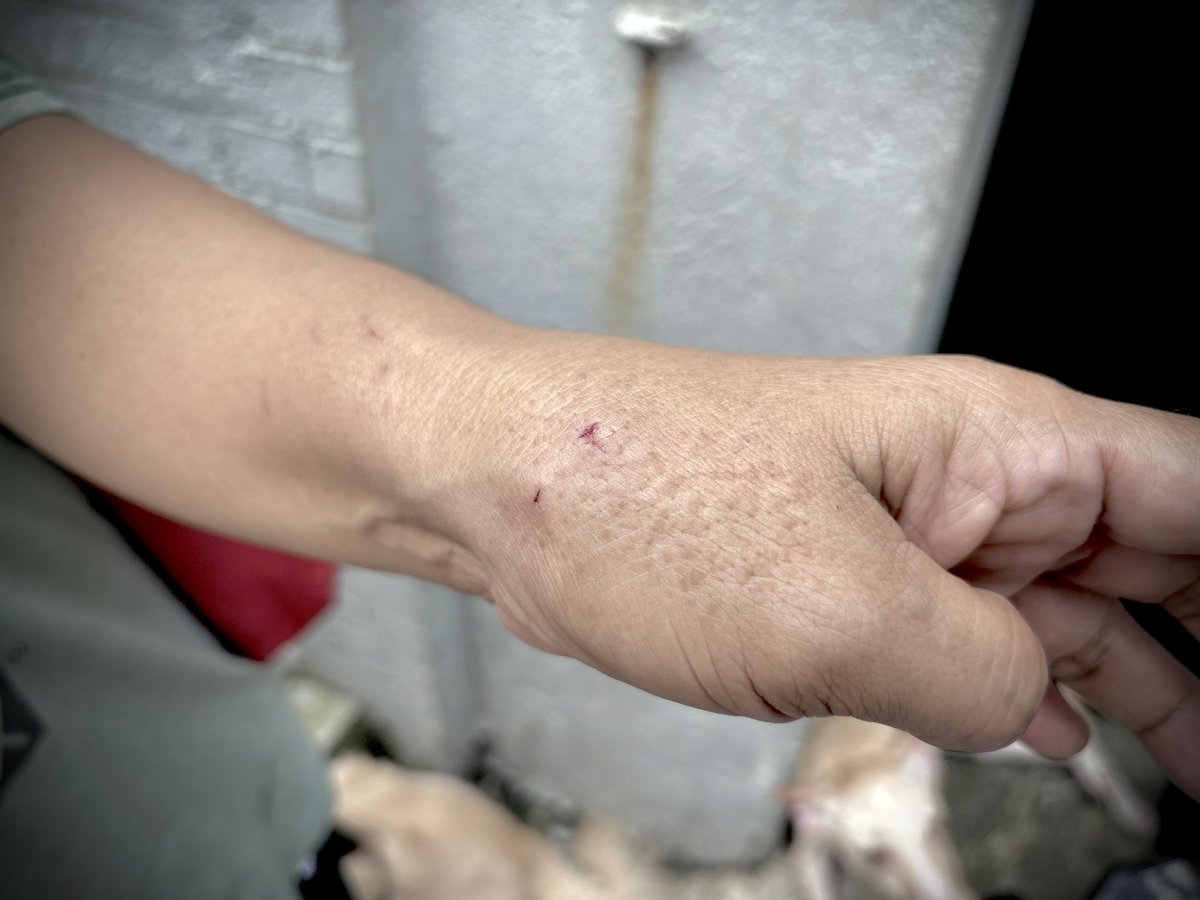 ABSCBNNews's tweet photo. ‘PARANG ANAK NA NAMIN ‘YAN’ 🐕🦮

Nakagat si Marissa Delicana ng isa sa dalawang alagang aso habang inililigtas nila ito sa sunog na sumiklab sa kanilang lugar sa Bgy. 704, Adriatico Street sa Malate, Maynila, ngayong Linggo, Setyembre 27.

Ayon kay Delicana, hindi niya kayang iwan ang mga alaga kahit nagmamadali sila sa paglikas dahil pamilya na ang turing nila sa mga ito. 

Nakatakda siyang magpaturok ng anti-rabies pagkatapos maisaayos ang mga naisalbang gamit. | via @jessiecruzat