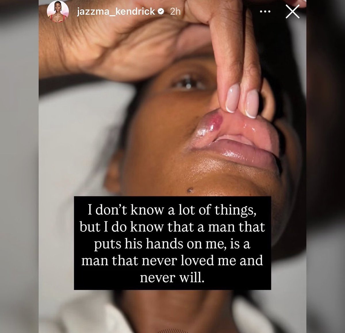 AkademiksTV's tweet photo. Rick Ross girlfriend exposes him for using her like a punching bag 👀 https://t.co/LU3BCIaPVe