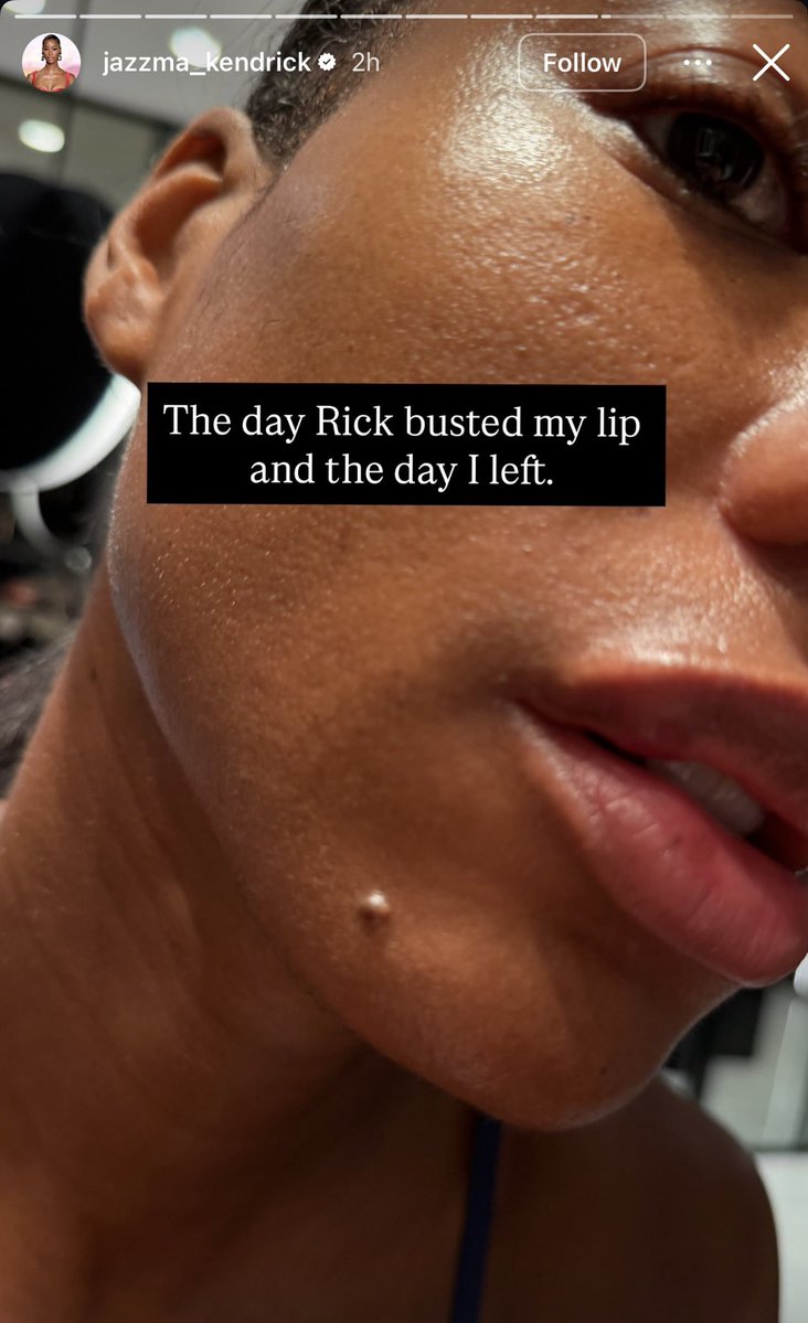 AkademiksTV's tweet photo. Rick Ross girlfriend exposes him for using her like a punching bag 👀 https://t.co/LU3BCIaPVe