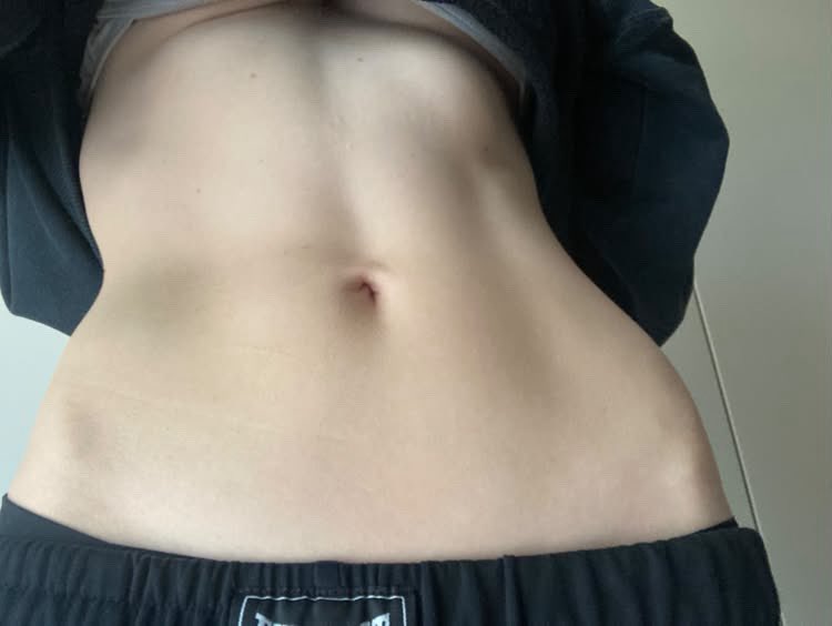 happyrexia's tweet photo. Pre breaking fast bodychecks #edrtwt 🐱 https://t.co/60C2RIFyqt