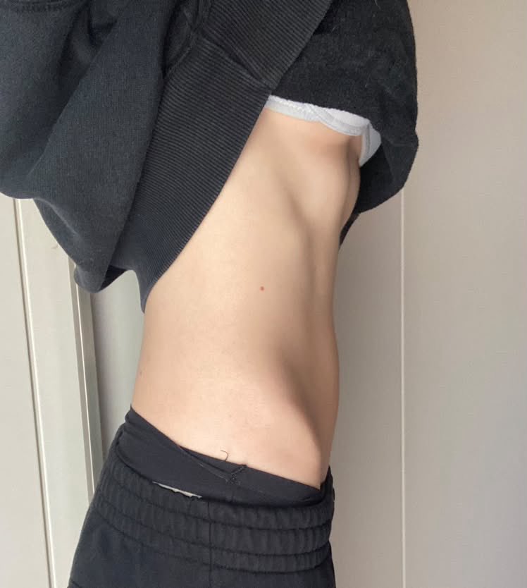 happyrexia's tweet photo. Pre breaking fast bodychecks #edrtwt 🐱 https://t.co/60C2RIFyqt