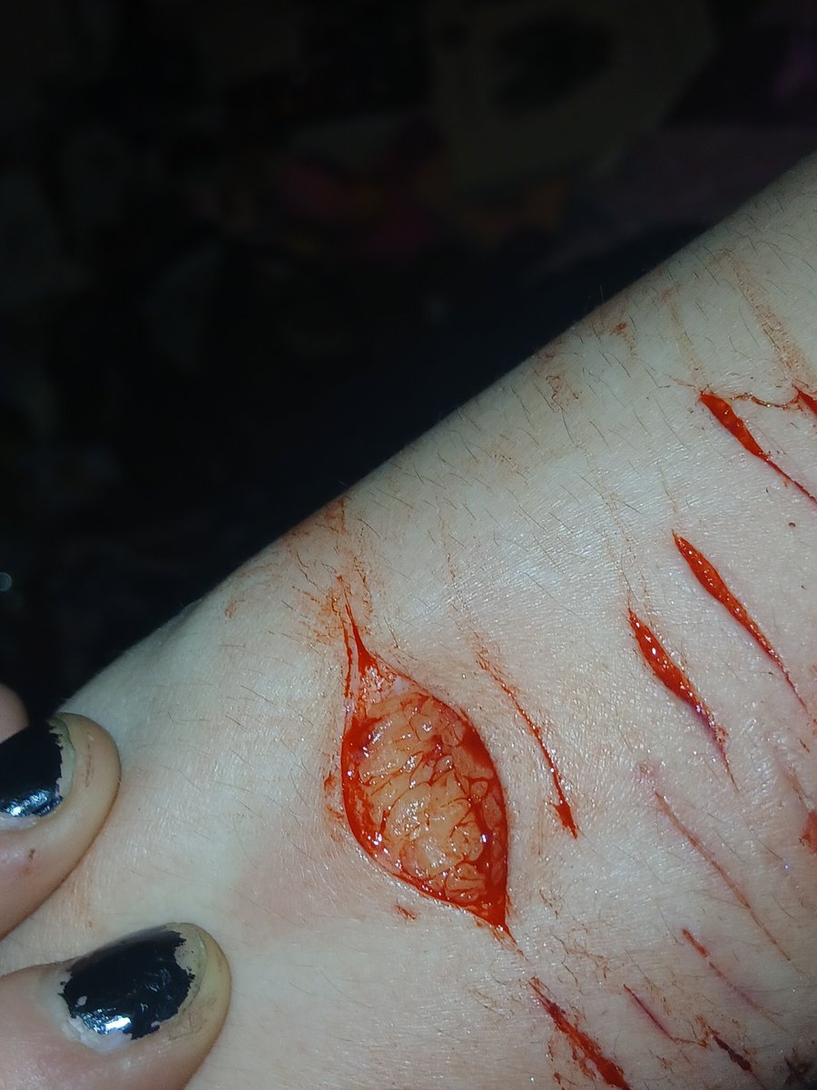 starz1eSweetiex's tweet photo. first time hitting deep beans kinda nervy 😖 #sfx #makeupsfx this is makeup! not real at all! sfx makeup can really be somethin cant it ? 😉 #fake #sh https://t.co/XsNEP1kISb