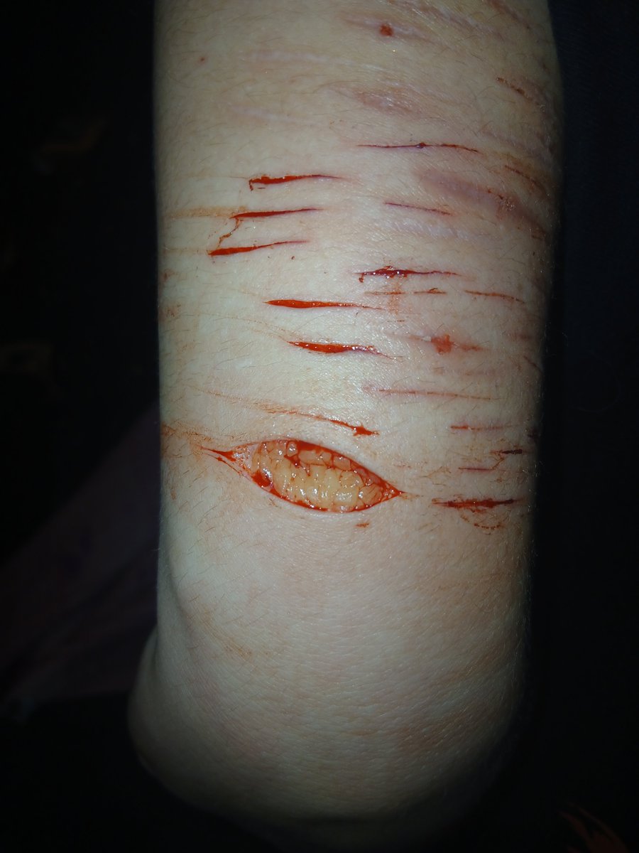 starz1eSweetiex's tweet photo. first time hitting deep beans kinda nervy 😖 #sfx #makeupsfx this is makeup! not real at all! sfx makeup can really be somethin cant it ? 😉 #fake #sh https://t.co/XsNEP1kISb