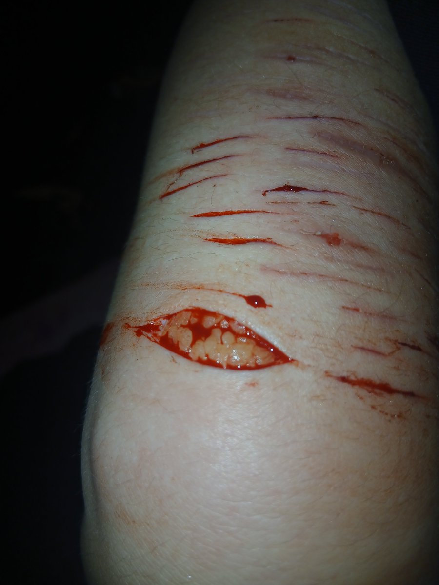 starz1eSweetiex's tweet photo. first time hitting deep beans kinda nervy 😖 #sfx #makeupsfx this is makeup! not real at all! sfx makeup can really be somethin cant it ? 😉 #fake #sh https://t.co/XsNEP1kISb