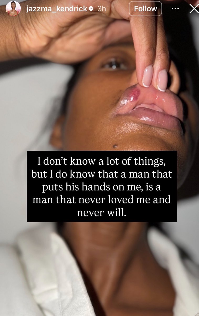 Toluwase_x's tweet photo. Rick Ross supermodel girlfriend, Jazzma Kendrick, took to her Instagram Story accusing him of physically a$saulting her, alleg!ng that he repeatedly hit her and left her with a busted lip.

“I don’t know a lot of things, but I do know that a man that puts his hands on me is a man that never loved me and never will.”