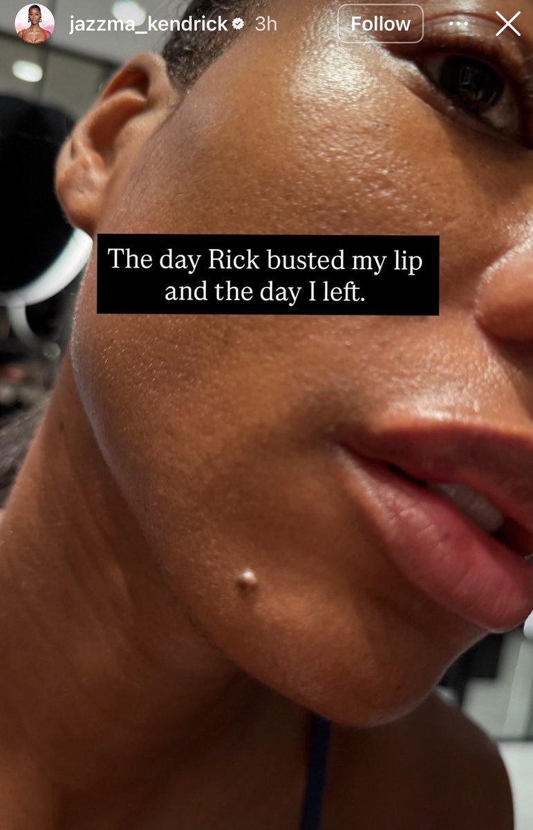 Toluwase_x's tweet photo. Rick Ross supermodel girlfriend, Jazzma Kendrick, took to her Instagram Story accusing him of physically a$saulting her, alleg!ng that he repeatedly hit her and left her with a busted lip.

“I don’t know a lot of things, but I do know that a man that puts his hands on me is a man that never loved me and never will.”