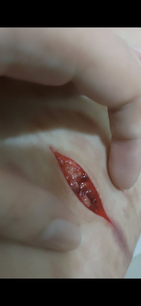 sup_bbgirl's tweet photo. 04/08/2023

sfx makeup AI generated https://t.co/Gx7AO9oyb3