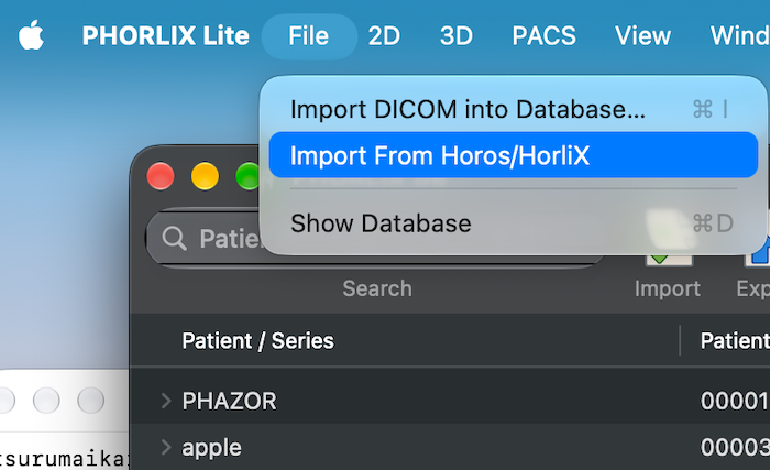 H_Inomata's tweet photo. 手が空いたので、PHORLIX Lite に #Horos/ #HorliX からデータ移行する機能を実装。
公式はアップデートしそうもないし、個別フォークは微妙な感じのが多いので。
機能はいたってシンプル。
File > Import From Horos/HorliX 押下、あとは指示に従う。
なお、Album とかは移せません。ダイコム持ってくるだけ。
App Store 公開前の RC(Release Candidate:リリース候補)です。試せる方はぜひ。
https://t.co/EEAyNldGQ1